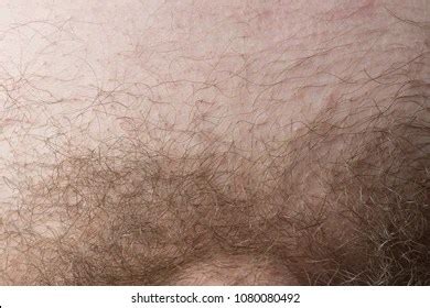 pubic hair images|Category : Pubic hair